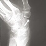 長男の手術無事に終わりました。